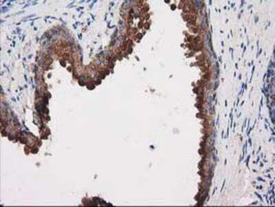 Immunohistochemistry-Paraffin: PKA R2 Antibody (OTI1F8) [NBP2-02520]