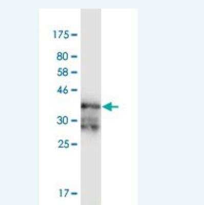 Western Blot: PKA R2 Antibody (3C7) [H00005576-M02]