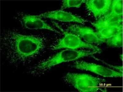 Immunocytochemistry/ Immunofluorescence: PKA R2 Antibody (6A9) [H00005576-M01]