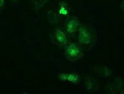Immunocytochemistry/ Immunofluorescence: PKA R2 Antibody (OTI1F8) - Azide and BSA Free [NBP2-73428]