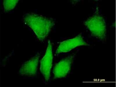 Immunocytochemistry/ Immunofluorescence: PKA RI beta Antibody [H00005575-B01P]