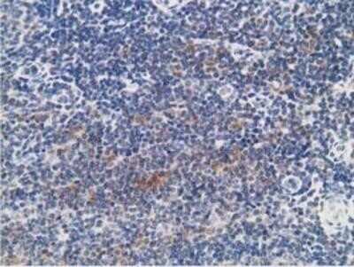 Immunohistochemistry: PKA RI beta Antibody (OTI2A3) - Azide and BSA Free [NBP2-73430]