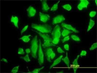 Immunocytochemistry/ Immunofluorescence: PKC alpha Antibody (2F11) [H00005578-M01]