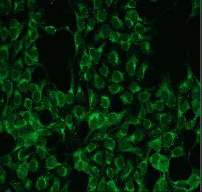 Immunocytochemistry/ Immunofluorescence: PKC alpha Antibody (G13-R) [NBP1-30121]