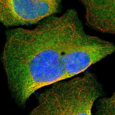 Immunocytochemistry/ Immunofluorescence: PKC alpha Antibody [NBP1-87268]