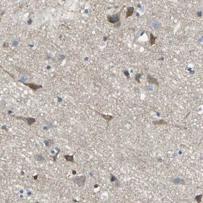 Immunohistochemistry-Paraffin: PKC alpha Antibody [NBP1-87269]