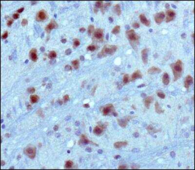 Immunohistochemistry-Paraffin: PKC alpha Antibody (MC5) [NB600-201]