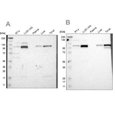 Western Blot: PKC alpha Antibody [NBP1-87268]