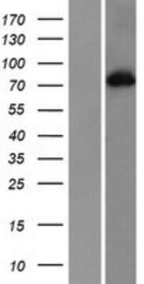 Western Blot: PKC alpha Overexpression Lysate [NBP2-04234]