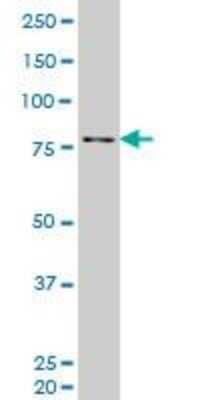 Western Blot: PKC delta Antibody (2E12) [H00005580-M06]