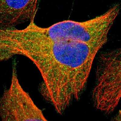 Immunocytochemistry/ Immunofluorescence: PKC delta Antibody [NBP1-90351]