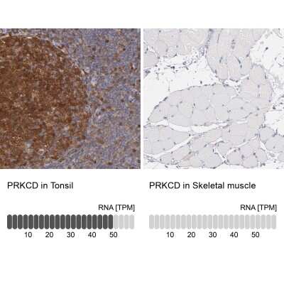 Immunohistochemistry-Paraffin: PKC delta Antibody [NBP1-90351]