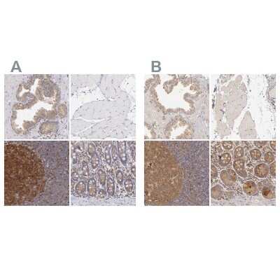 Immunohistochemistry-Paraffin: PKC delta Antibody [NBP1-90351]