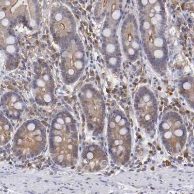 Immunohistochemistry-Paraffin: PKC delta Antibody [NBP1-90351]
