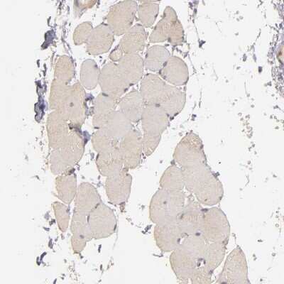 Immunohistochemistry-Paraffin: PKC delta Antibody [NBP1-90957]