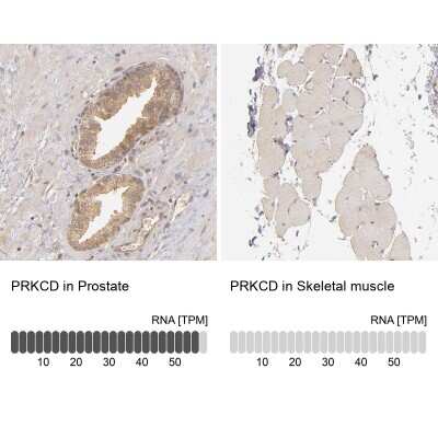 Immunohistochemistry-Paraffin: PKC delta Antibody [NBP1-90957]