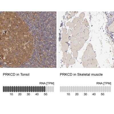 Immunohistochemistry-Paraffin: PKC delta Antibody [NBP1-90957]