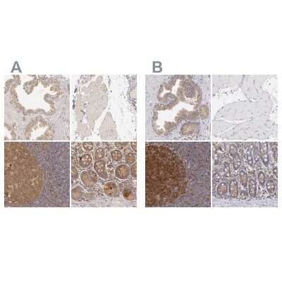 Immunohistochemistry-Paraffin: PKC delta Antibody [NBP1-90957]