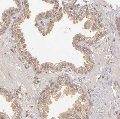 Immunohistochemistry-Paraffin: PKC delta Antibody [NBP1-90957]