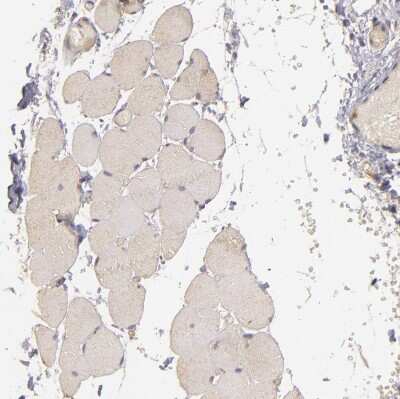 Immunohistochemistry-Paraffin: PKC delta Antibody [NBP1-90957]
