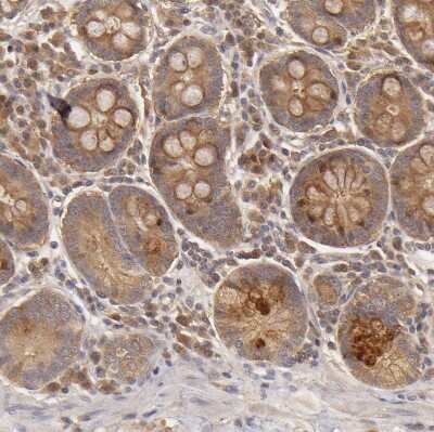 Immunohistochemistry-Paraffin: PKC delta Antibody [NBP1-90957]