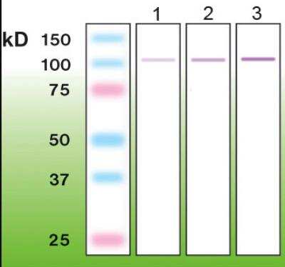 Western Blot: PKC delta Antibody (K15-K) [NBP1-30125]
