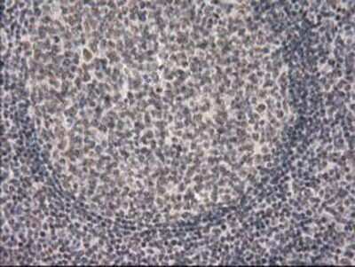 Immunohistochemistry-Paraffin: PKC epsilon Antibody (OTI4G8) [NBP2-03620]