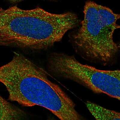Immunocytochemistry/ Immunofluorescence: PKC epsilon Antibody [NBP2-54970]