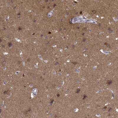 Immunohistochemistry-Paraffin: PKC epsilon Antibody [NBP2-38531]