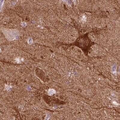 Immunohistochemistry-Paraffin: PKC epsilon Antibody [NBP2-38531]