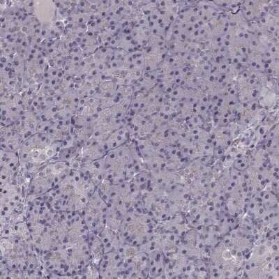 Immunohistochemistry-Paraffin: PKC epsilon Antibody [NBP2-38531]
