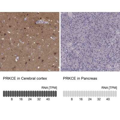 Immunohistochemistry-Paraffin: PKC epsilon Antibody [NBP2-38531]