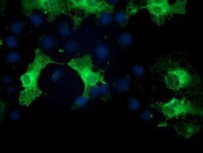 Immunocytochemistry/ Immunofluorescence: PKC epsilon Antibody (OTI4G8) - Azide and BSA Free [NBP2-73438]