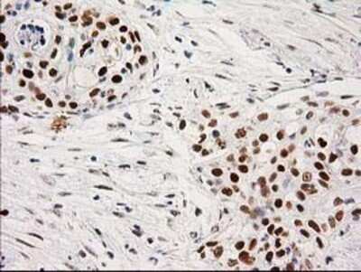 Immunohistochemistry: PKC epsilon Antibody (OTI4G8) - Azide and BSA Free [NBP2-73438]