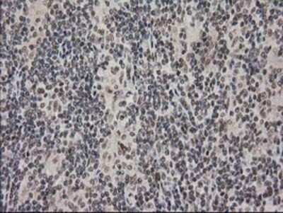 Immunohistochemistry: PKC epsilon Antibody (OTI4G8) - Azide and BSA Free [NBP2-73438]