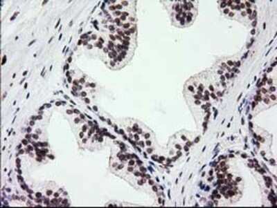 Immunohistochemistry: PKC epsilon Antibody (OTI4G8) - Azide and BSA Free [NBP2-73438]