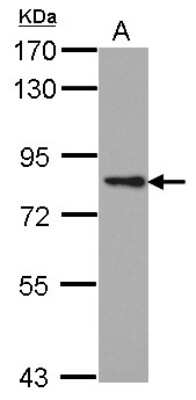 Western Blot: PKC epsilon Antibody [NBP2-19848]