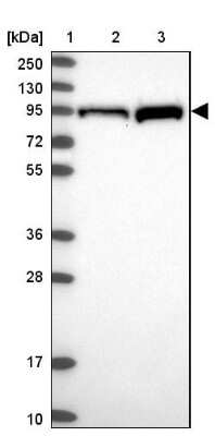 Western Blot: PKC epsilon Antibody [NBP2-38531]