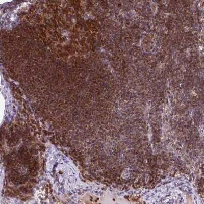 Immunohistochemistry-Paraffin: PKC eta Antibody [NBP2-38711]