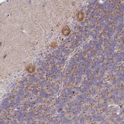 Immunohistochemistry-Paraffin: PKC eta Antibody [NBP2-38711]