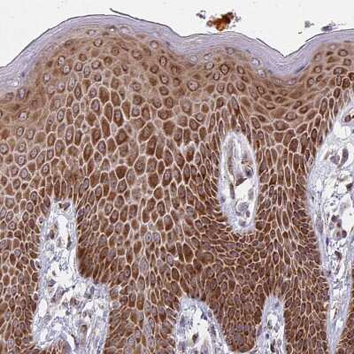 Immunohistochemistry-Paraffin: PKC eta Antibody [NBP2-38711]