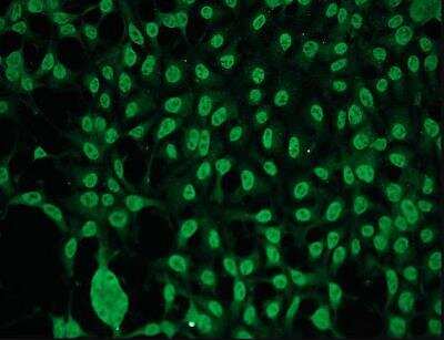 Immunocytochemistry/ Immunofluorescence: PKC gamma Antibody (A12-H) [NBP1-30124]