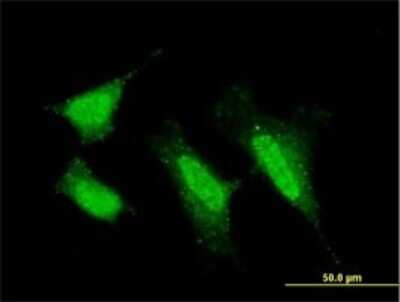 Immunocytochemistry/ Immunofluorescence: PKC iota Antibody (1G11) [H00005584-M01]