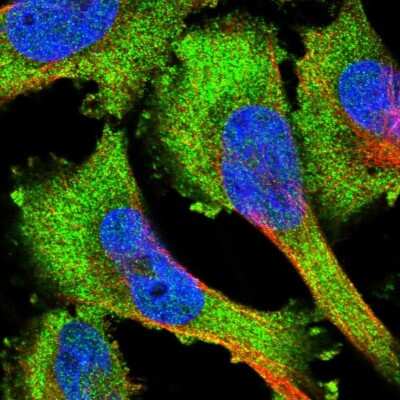 Immunocytochemistry/ Immunofluorescence: PKC mu Antibody [NBP1-87789]