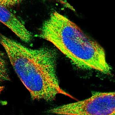 Immunocytochemistry/ Immunofluorescence: PKC zeta Antibody [NBP1-87270]