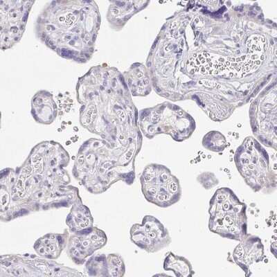 Immunohistochemistry-Paraffin: PKDREJ Antibody [NBP1-86318]