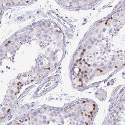 Immunohistochemistry-Paraffin: PKDREJ Antibody [NBP1-86318]