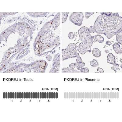 Immunohistochemistry-Paraffin: PKDREJ Antibody [NBP1-86318]