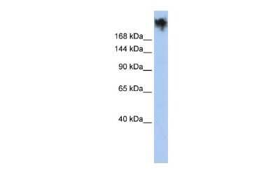 Western Blot: PKDREJ Antibody [NBP2-83398]