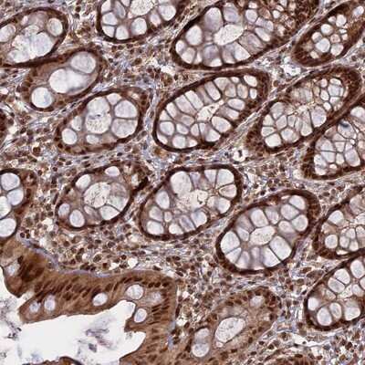 Immunohistochemistry-Paraffin: PKIG Antibody [NBP1-86212]